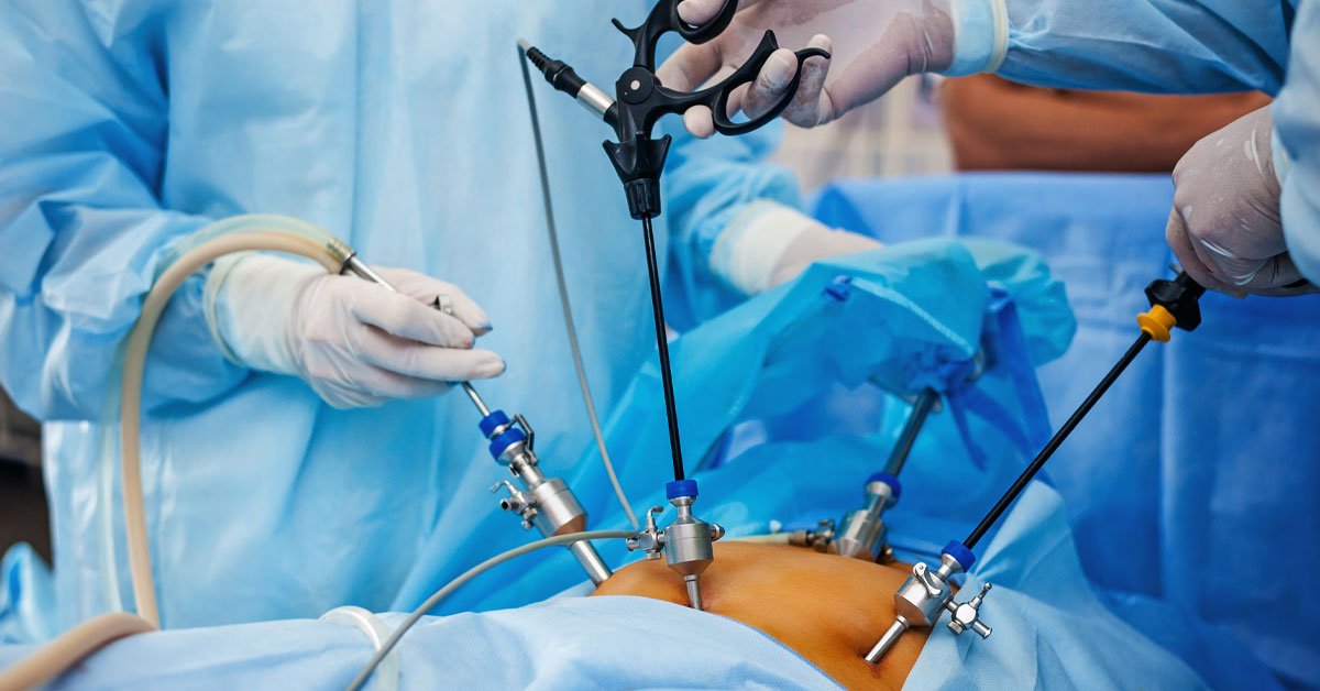 Laparoscopia-diagnostica-si-operatorie