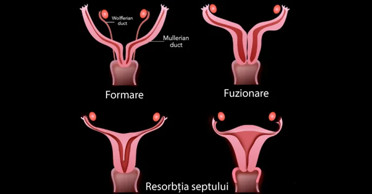 sept-uterin