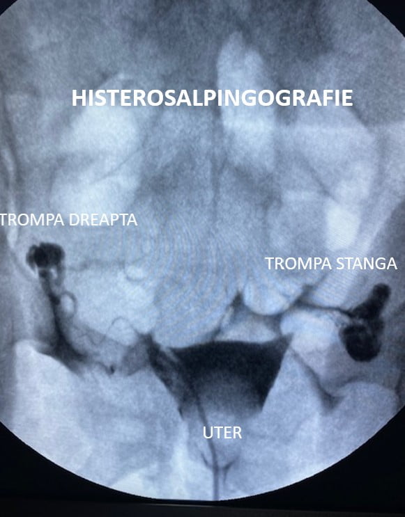 drj Histero 3