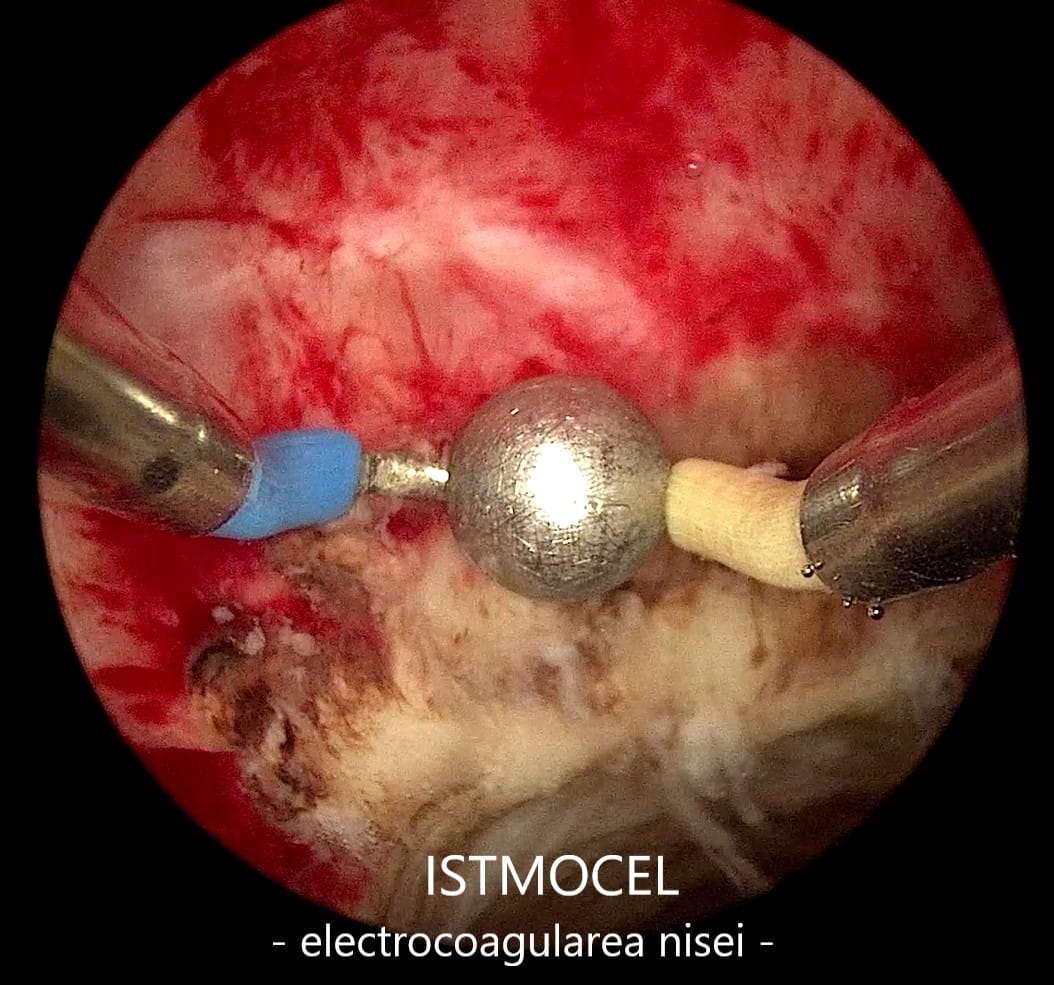 istmocel9 istmocel