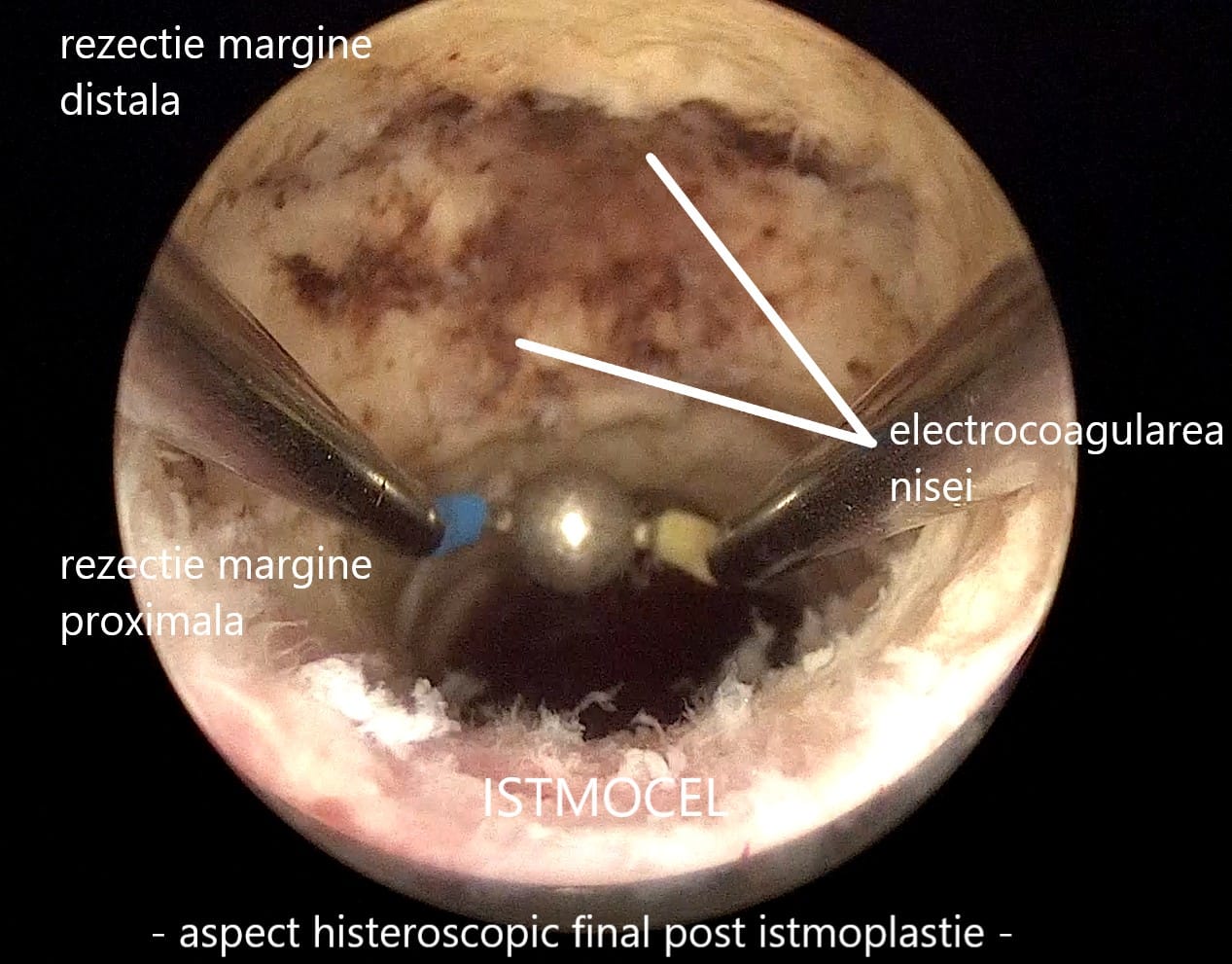 istmocel12
