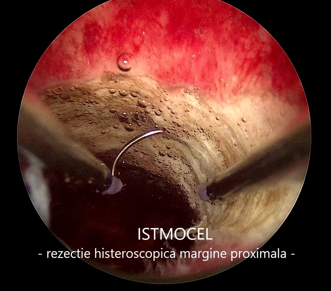 istmocel7 istmocel