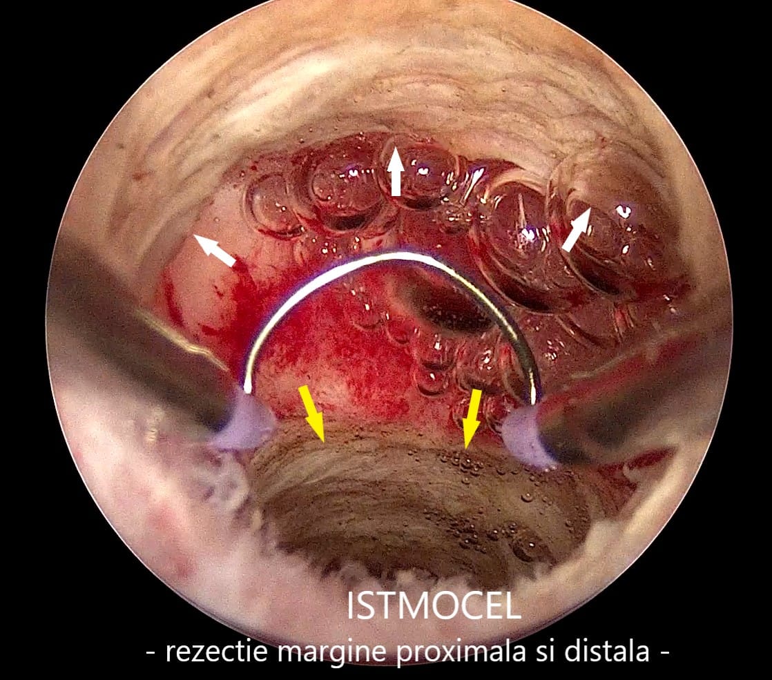 istmocel8 istmocel